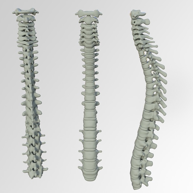 spine sclerosis